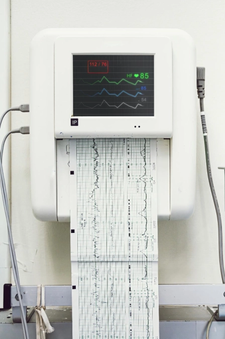 фото электрокардиограммы